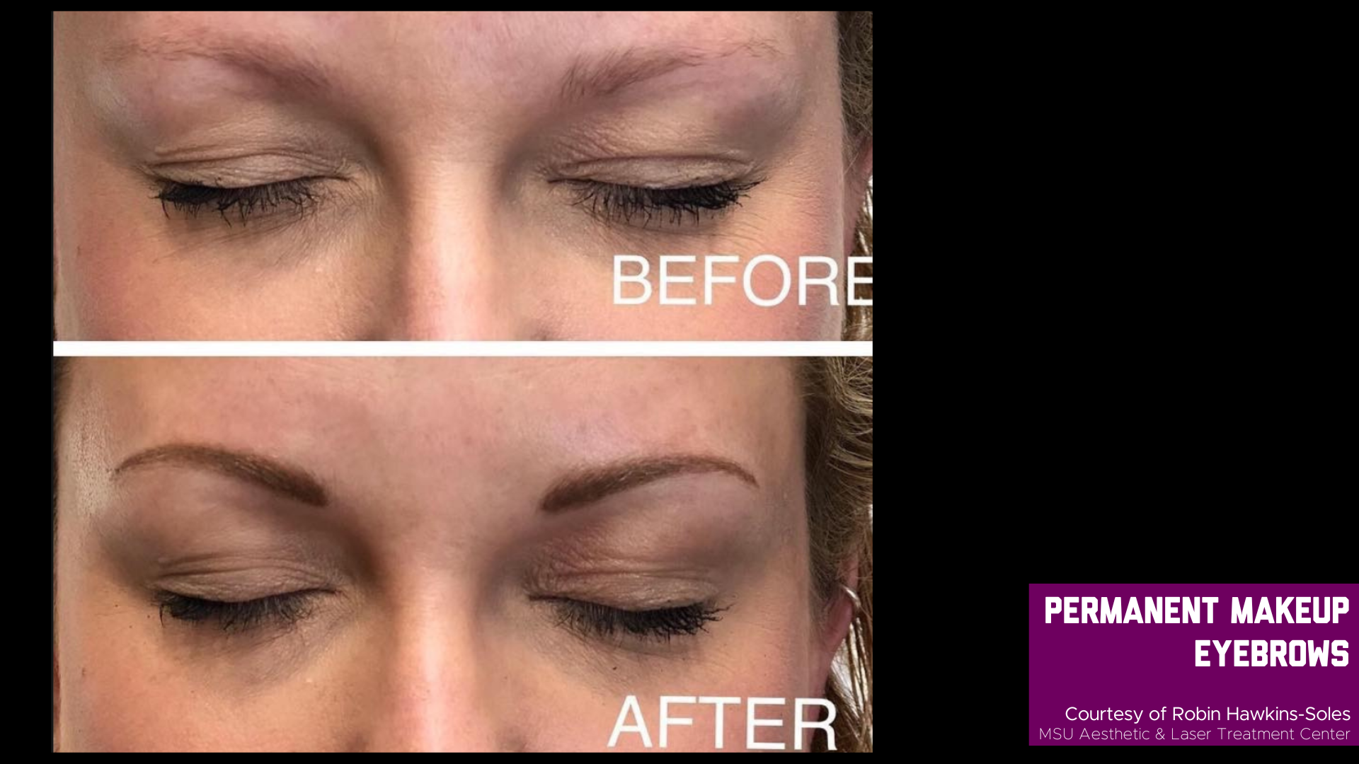 before and after treatment photos